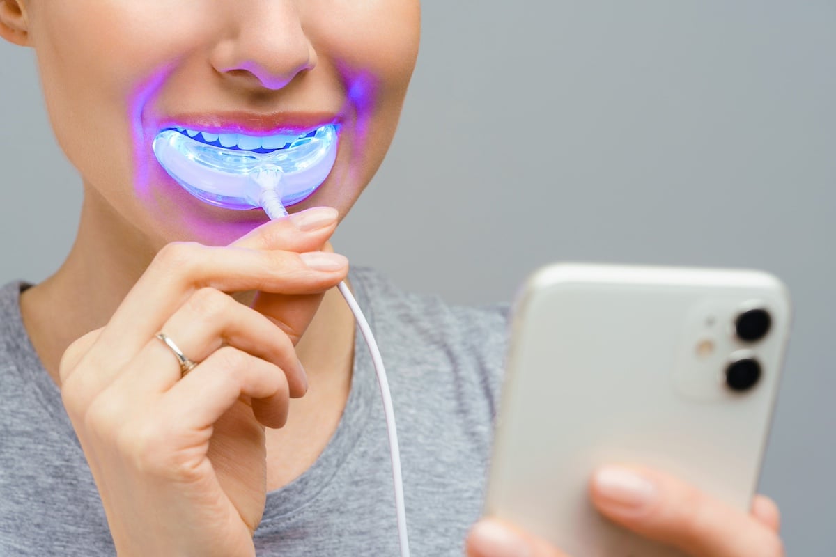 home teeth whitening 2 home teeth whitening 2